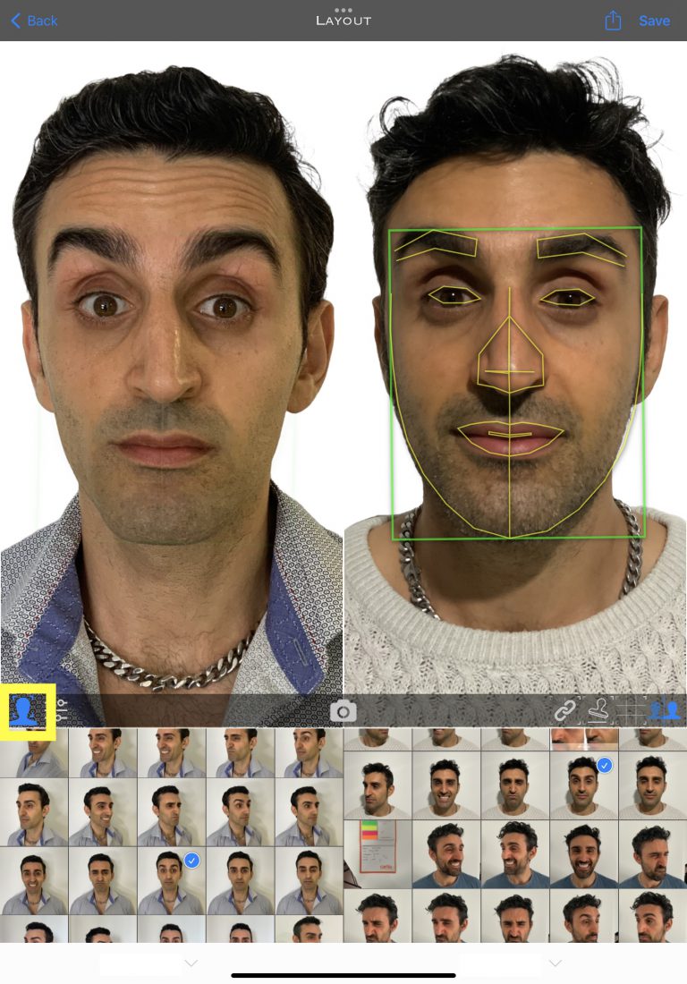 Step By Step Guide on How to Use Treatment Pad Treatment Pad